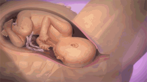 微信图片_20170908155410.gif
